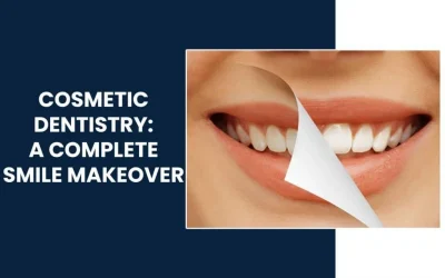 Cosmetic Dentistry : A Complete Smile Makeover