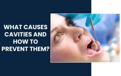 What Causes Cavities and How to Prevent Them?