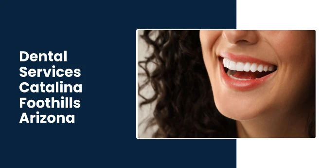 Affordable Dental Implants, Crowns & Bridges in Catalina Foothills AZ - Rincon's Family Dentistry Affordable Dental Implants, Crowns & Bridges in Catalina Foothills AZ - Rincon's Family Dentistry