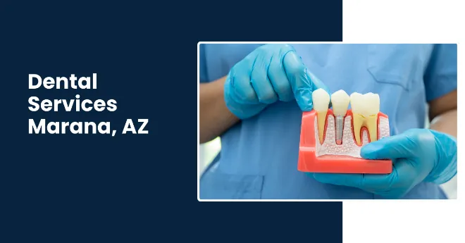 Affordable and best dental bridges, implants and crowns treatment in Marana AZ. Affordable and best dental bridges, implants and crowns treatment in Marana AZ.