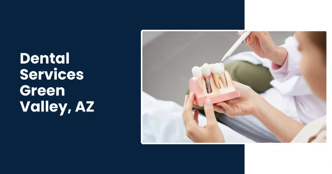 Best Affordable Dental Implants, Crowns and bridges specialist in Green Valley AZ by Rincon's Family and Pediatric Dentistry Best Affordable Dental Implants, Crowns and bridges specialist in Green Valley AZ by Rincon's Family and Pediatric Dentistry