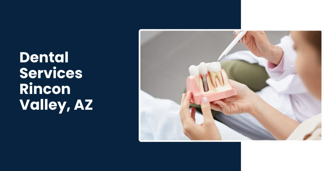 Best Affordable Dental Implants, Crowns and bridges specialist in Rincon Valley AZ Best Affordable Dental Implants, Crowns and bridges specialist in Rincon Valley AZ