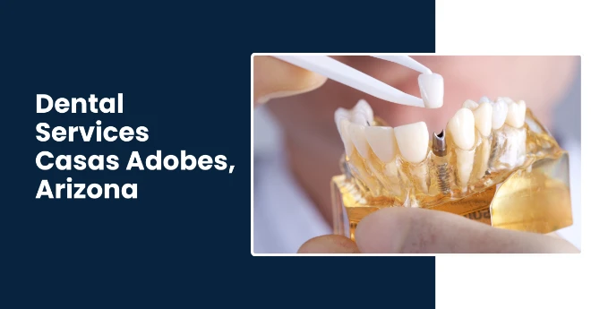 Best Dental Bridges, Implants & Crown Dentistry in Casas Adobes, AZ. Affordable and Insurance Options Best Dental Bridges, Implants & Crown Dentistry in Casas Adobes, AZ. Affordable and Insurance Options