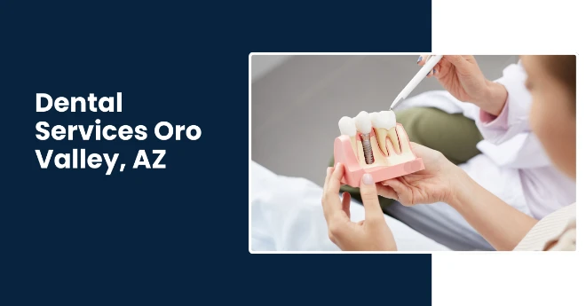 Best and Affordable Dental Implants, Bridges and Crowns in Oro Valley AZ By Rincons Family Dentistry Specialist Best and Affordable Dental Implants, Bridges and Crowns in Oro Valley AZ By Rincons Family Dentistry Specialist