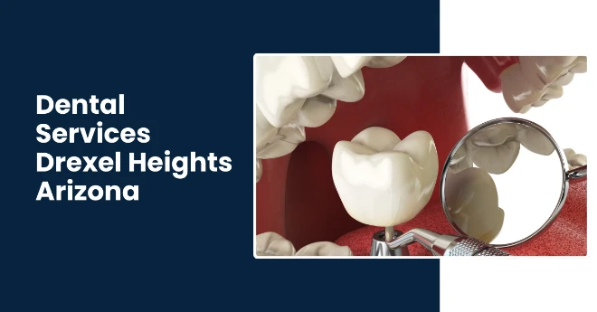 Dental-ImDental Implants, Bridges, Crowns and Complete Dental Services in Drexel Heights AZ - Rincons Family Dentistryplants-Bridges-Crowns-and-Complete-Dental-Services-in-Drexel-Heights-AZ-Rincons-Family-Dentistry Dental Implants, Bridges, Crowns and Complete Dental Services in Drexel Heights AZ - Rincons Family Dentistry