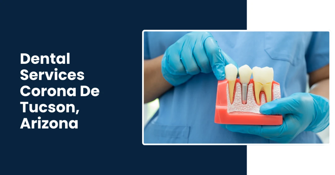 Dental Implants, Crowns and bridges specialist in Corona De Tucson AZ by Rincon's Family and Pediatric Dentistry Dental Implants, Crowns and bridges specialist in Corona De Tucson AZ by Rincon's Family and Pediatric Dentistry