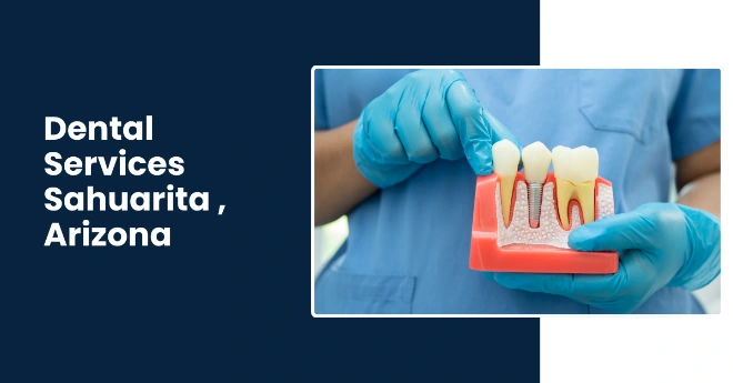Dental Implants, Crowns and bridges specialist in Sahuarita AZ by Rincon's Family and Pediatric Dentistry Dental Implants, Crowns and bridges specialist in Sahuarita AZ by Rincon's Family and Pediatric Dentistry
