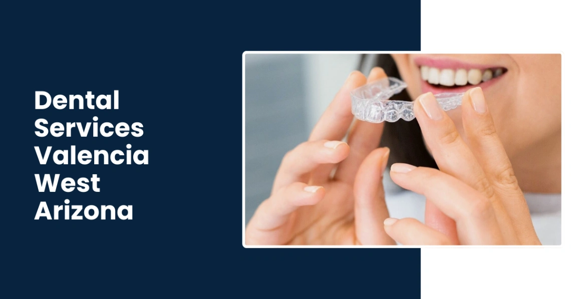 Best Dental Implants, Bridges, And Crowns in Valencia West Arizona-Rincon's Family Dentistry Best Dental Implants, Bridges, And Crowns in Valencia West Arizona-Rincon's Family Dentistry