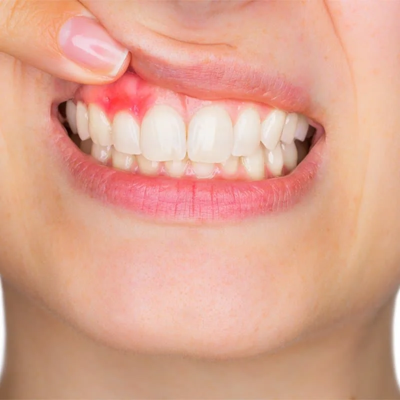 Best Local Periodontics in Tucson AZ-Rincon Family Dentistry