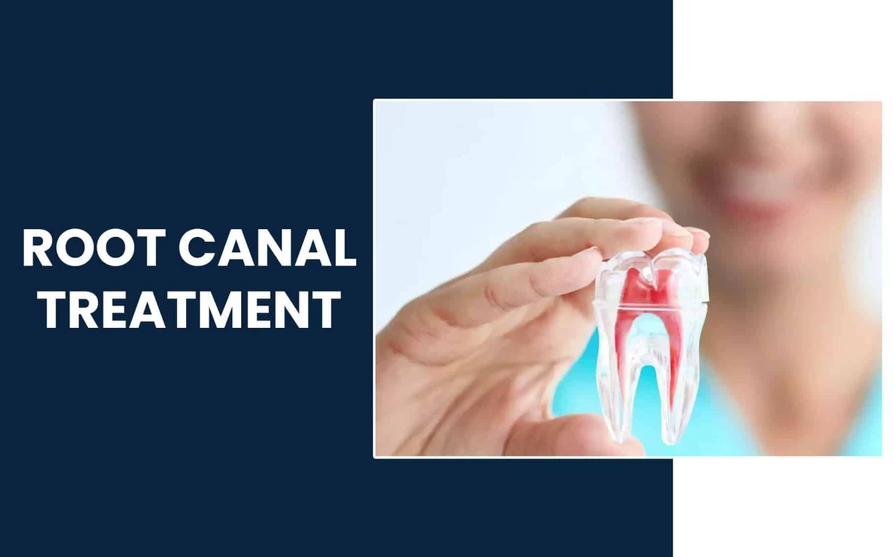 Best-Root-Canal-Treatment-in Tucson AZ and nearby Areas-Rincon Family Dentistry