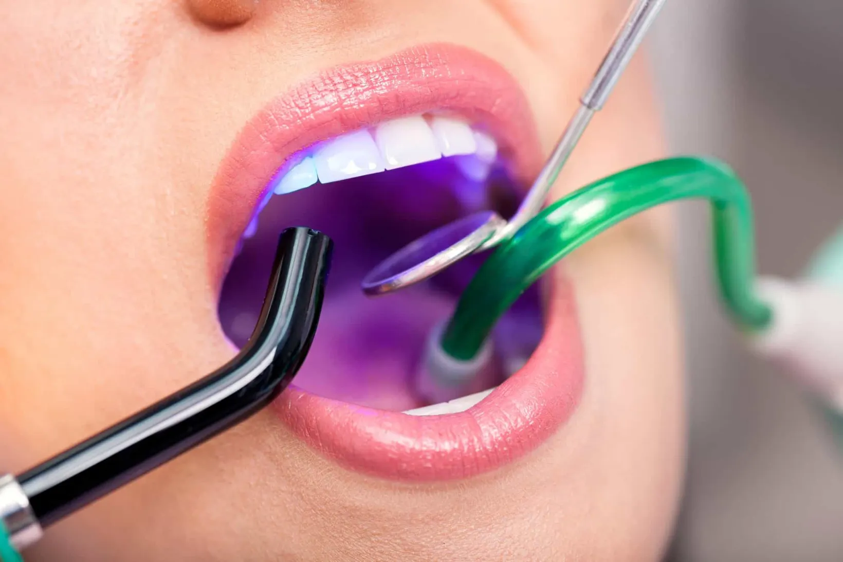 Restorative dentistry specialist in Tucson AZ-Rincon Family Dentistry