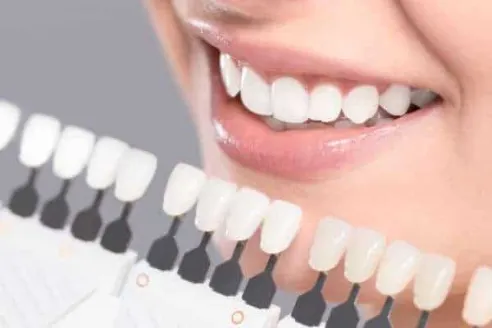 teeth-whitening-services-in-tucson-with-foulk-dental-Rincon Family Dentistry