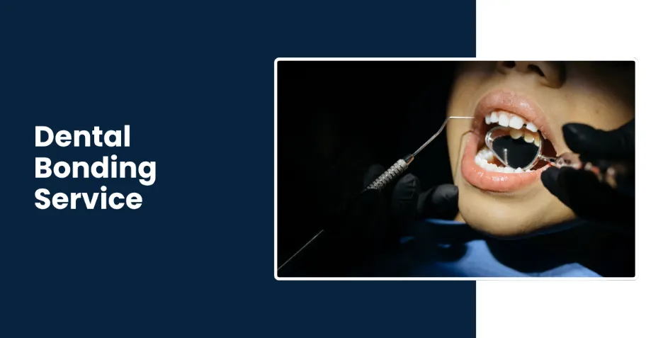 Best dental bonding service in Tucson AZ - Rincon Family Dentistry Best dental bonding service in Tucson AZ - Rincon Family Dentistry