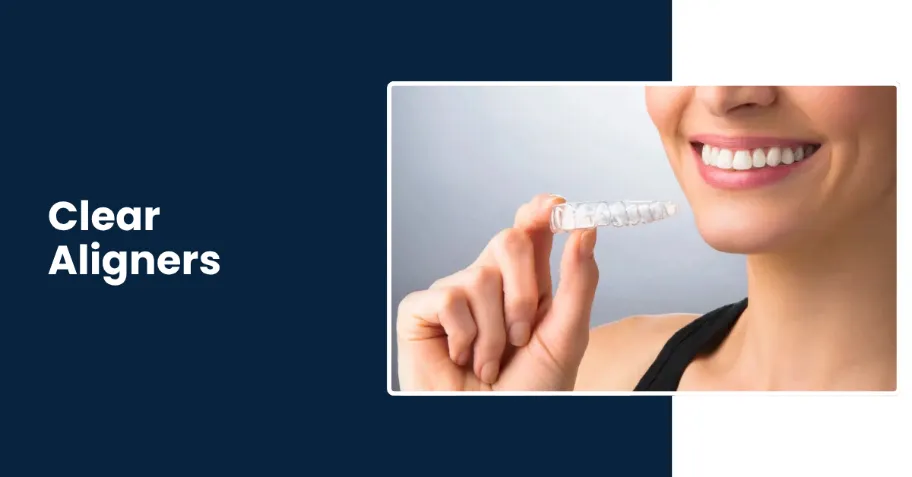 Clear Aligners treatment for dental health in Tucson AZ - Rincon Family Dentistry Clear Aligners treatment for dental health in Tucson AZ - Rincon Family Dentistry