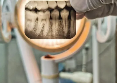 Dental imaging for tooth and gums - Rincon Family Dentistry Tucson