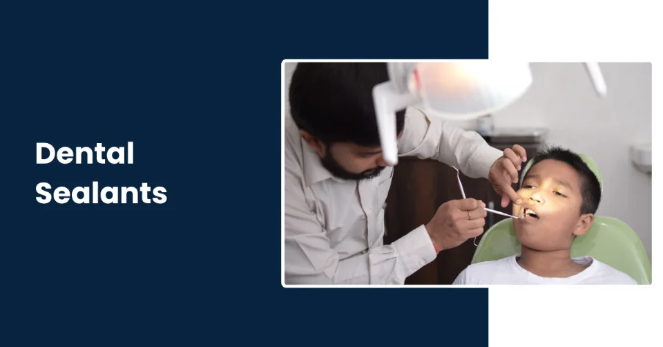 High quality dental sealents and application in Tucson - Rincon Family Dentistry High quality dental sealents and application in Tucson - Rincon Family Dentistry