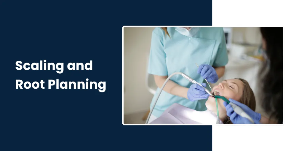 Professional Scaling and Root Planning in Tucson - Rincon Family Dentistry Professional Scaling and Root Planning in Tucson - Rincon Family Dentistry
