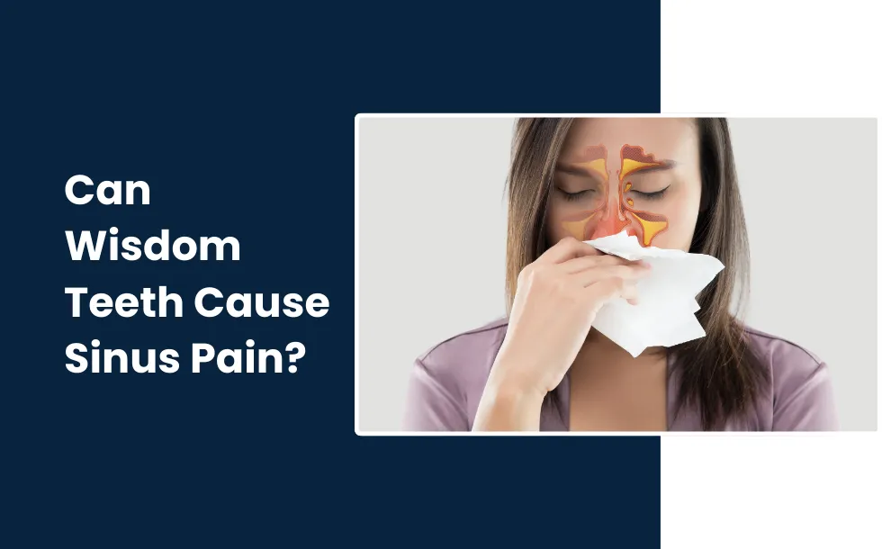 Can Wisdom Teeth Cause Sinus Pain