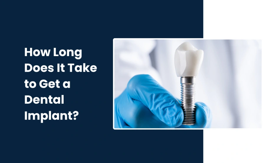 How Long Does It Take to Get a Dental Implant