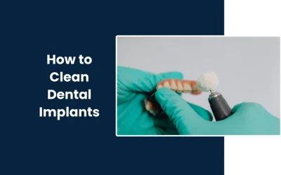 How to Clean Dental Implants?