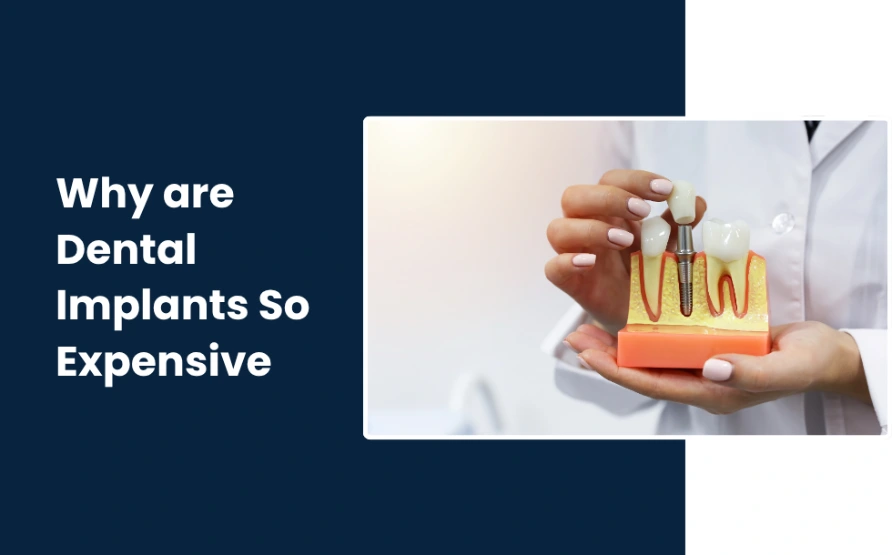 Why are Dental Implants So Expensive
