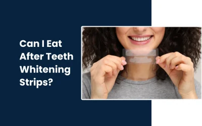 Can I Eat After Teeth Whitening Strips?