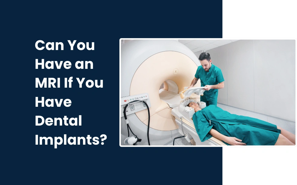 Can You Have an MRI If You Have Dental Implants - comprehesive guide