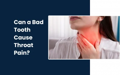 Can a Bad Tooth Cause Throat Pain?