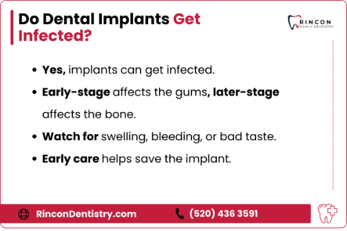 Do Dental Implants Get Infected - infographic