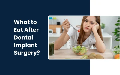 What to Eat After Dental Implant Surgery?