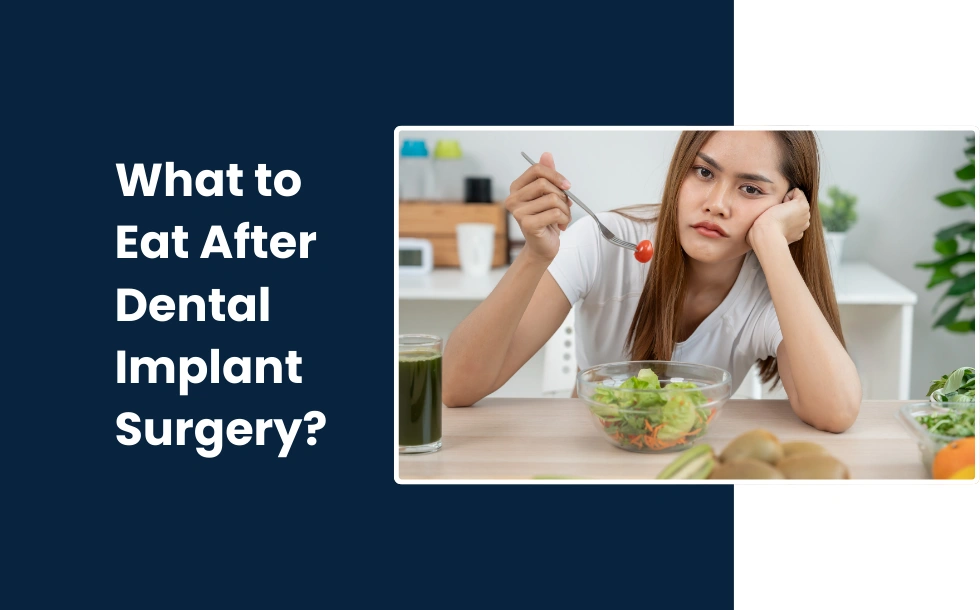 What to Eat After Dental Implant Surgery - comprehesive guide