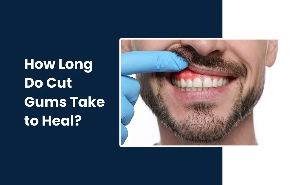 How Long Do Cut Gums Take to Heal_ - A comprehesive guide