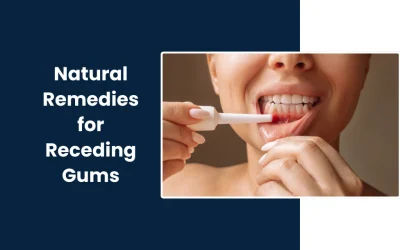 Best Natural Remedies for Receding Gums
