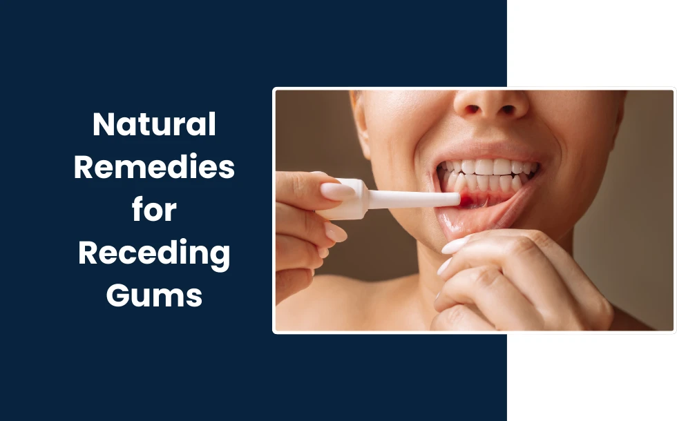 Natural Remedies for Receding Gums - A comprehesive guide